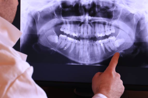 Best Cracked Tooth Emergency Dentist  in Highlands, NC